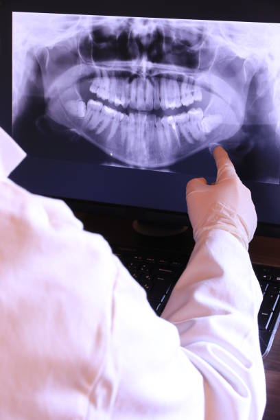 Best Emergency Dental Care for Broken or Chipped Teeth in San Fernando, CA